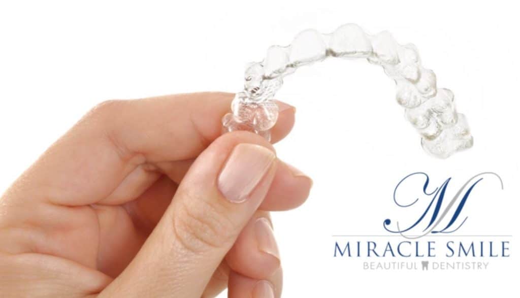 Invisalign - Miracle smile