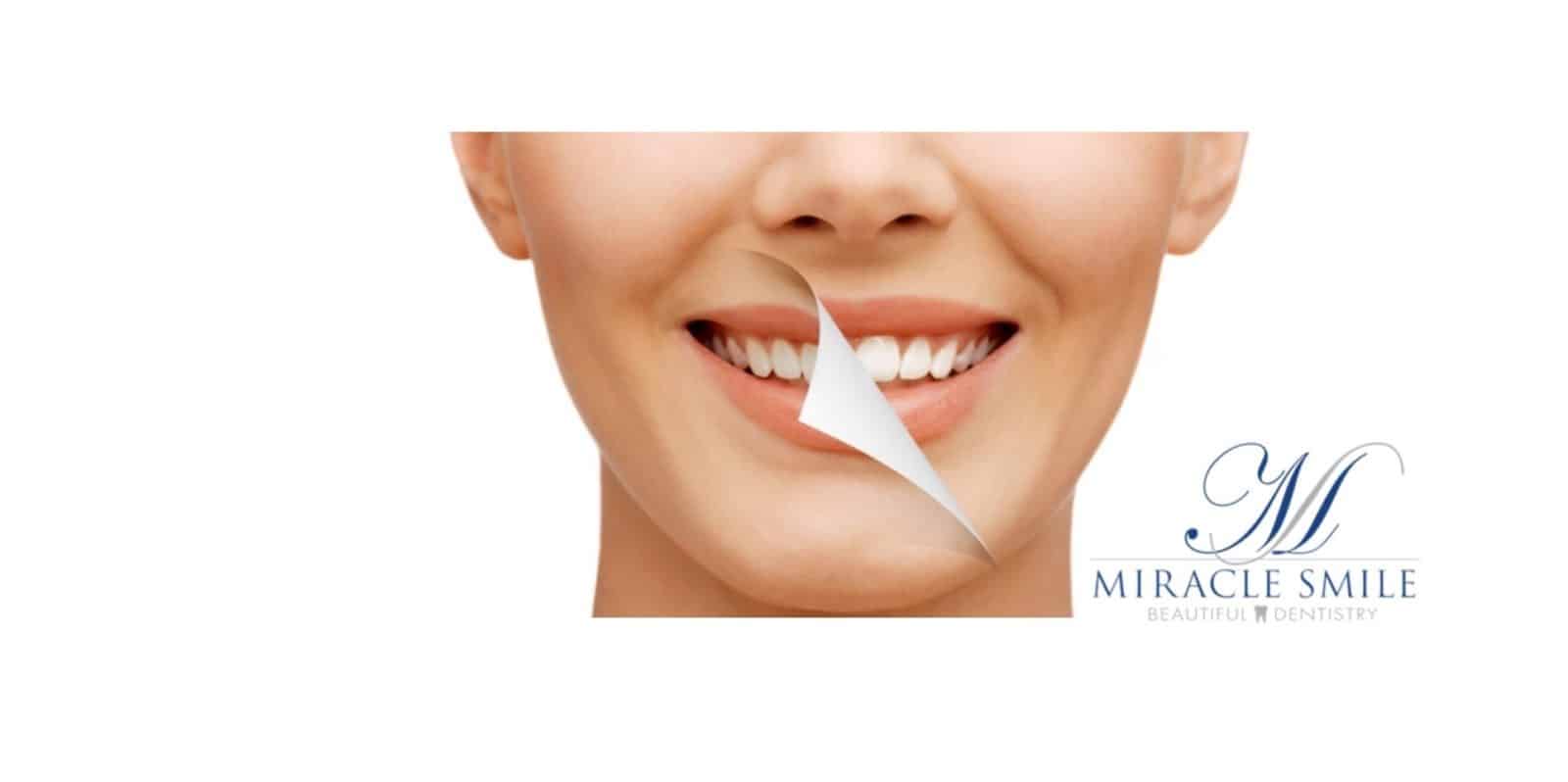Miracle Smile Dental