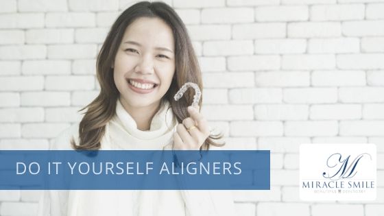 do it yourself aligners