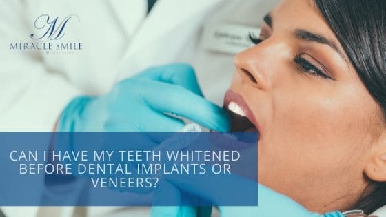 Teeth whitening and dental implants