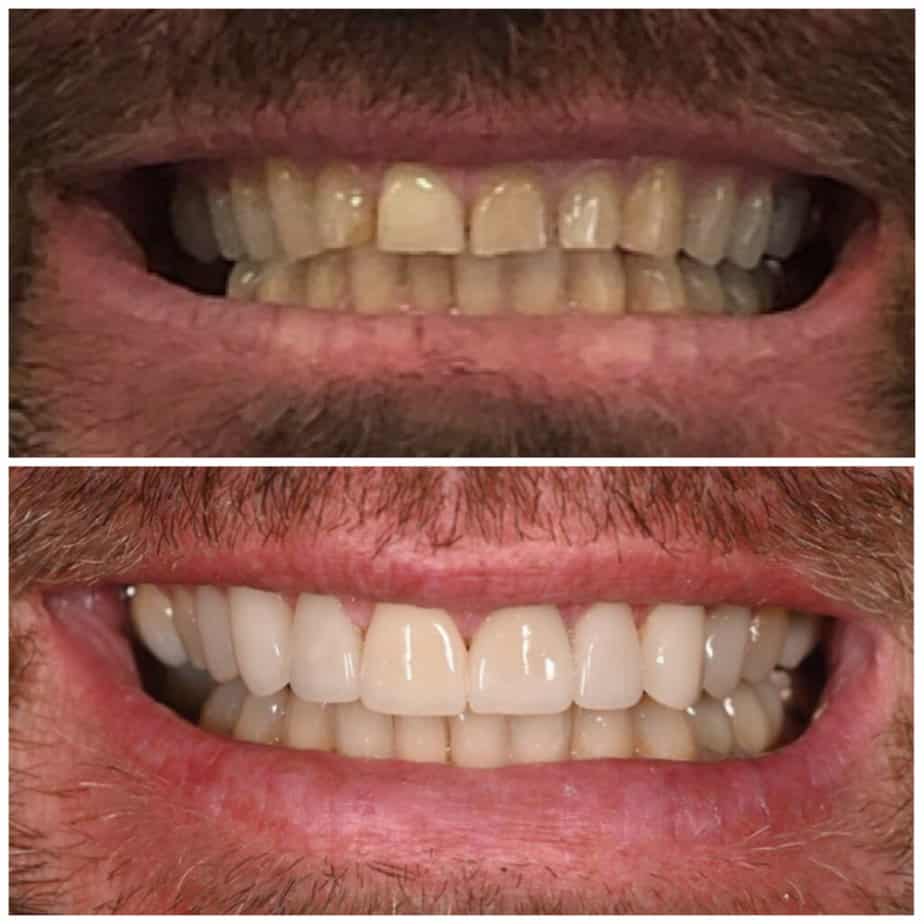 cosmetic dentistry smile transformation