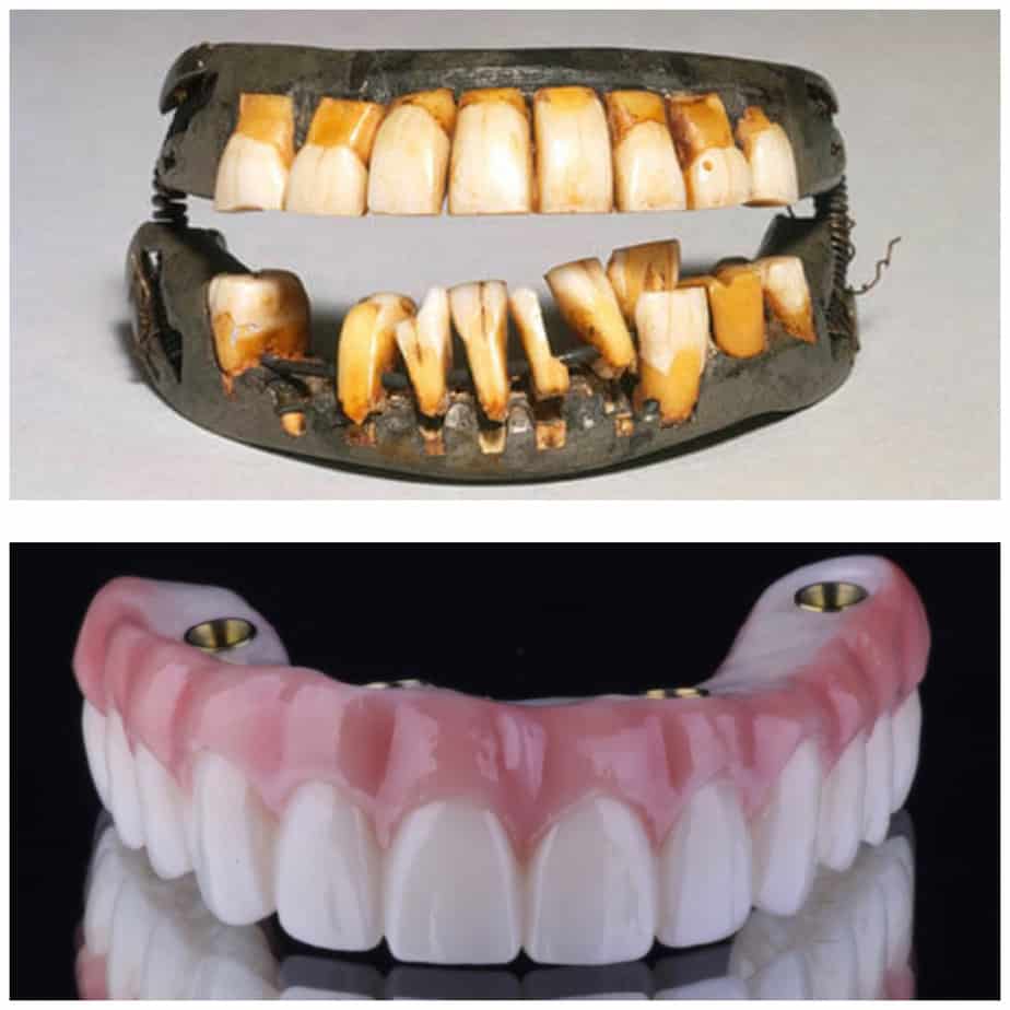 Dental health evolution