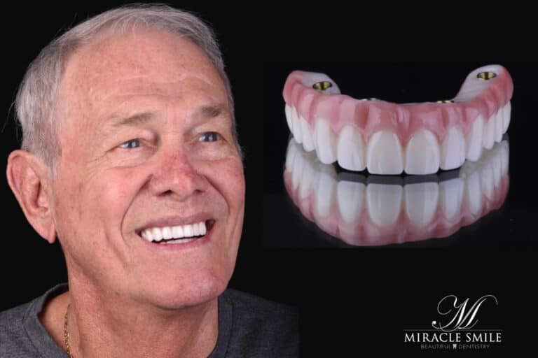Smiling dental implant patient - Miracle Smile Dentistry