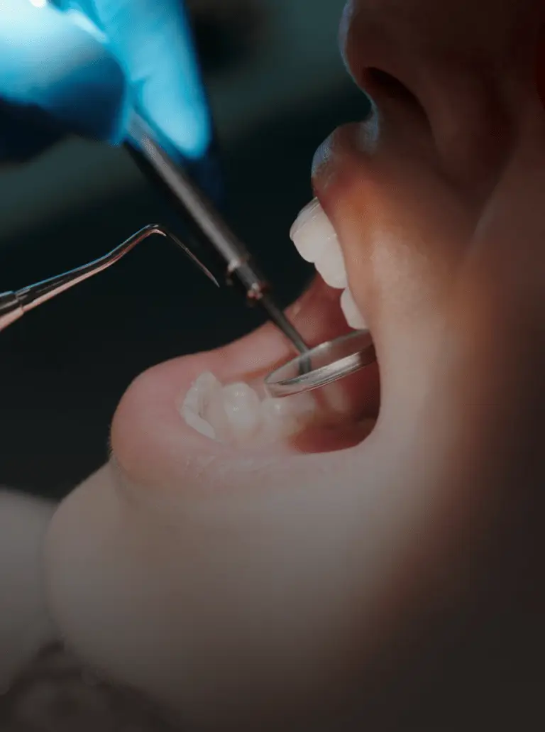 Dental Crowns