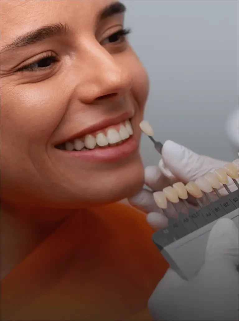 Dental Veneers